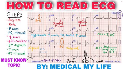 how to read ekg test results|How to Read an EKG: An Interpretation Guide with Sample  .